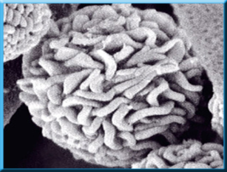 Addressing any challenges or obstacles during the remediation process